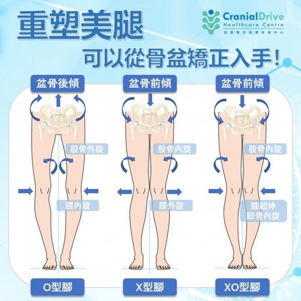 腿型矯正（單次）